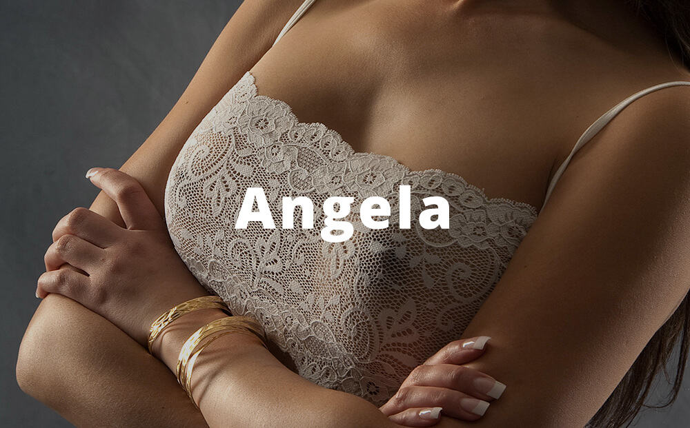 Gallery Breast Aug Angela