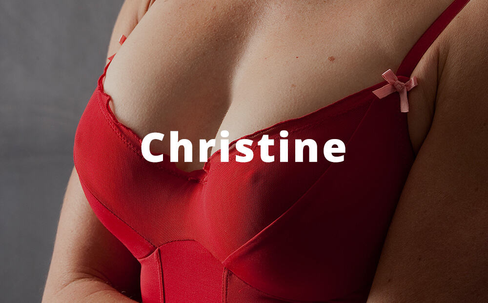 christine Breast Augmentation Before and After