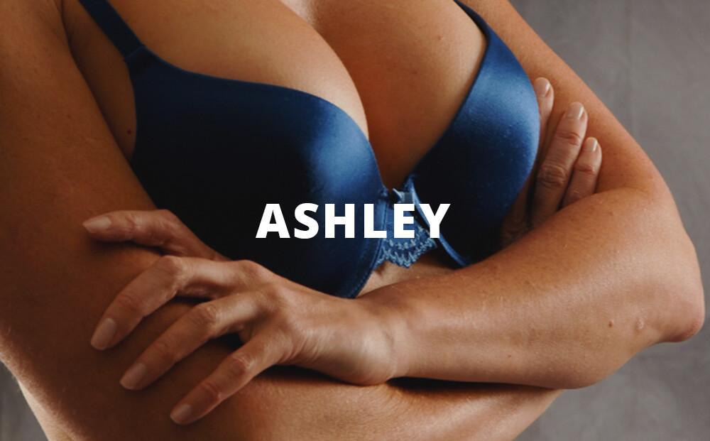 Ashley Breast Augmentation Pictures